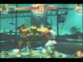 SFIV Ken/Dhalsim vs Ryu set 03 @ Jungin Arcade, Korea