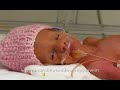 Premature Baby Lily
