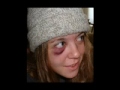 black-eyes-volume-4.html