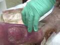 maggot therapy 3