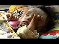 Click here to watch this video 北韓飢荒未解決殺人食肉當眾槍斃！貪腐收糧援不分發給災民！