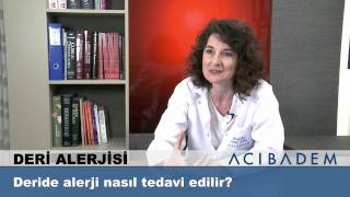 Deride alerji nasıl tedavi edilir ?