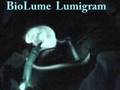 Gallbladder Lumigram