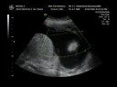 Oliver Novoa - 4D Ultrasound - Part 2