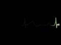 ELECTROCARDIOGRAMA ELECTROCARDIOGRAMA