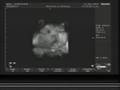 Baby Wee 4D Scan