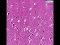 Histopathology Brain--Rabies