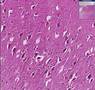 Histopathology Brain--Rabies