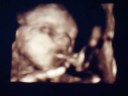 videos de Chloe's First Video (3D Sonogram) Part 2