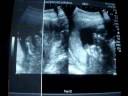 Copia de NUESTRO BEBE 16 SEMANAS.avi Copia de NUESTRO BEBE 16 SEMANAS.avi