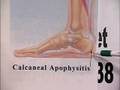 videos de IPMA 'Feet Forward' - Kids Feet Health One -- Part 2