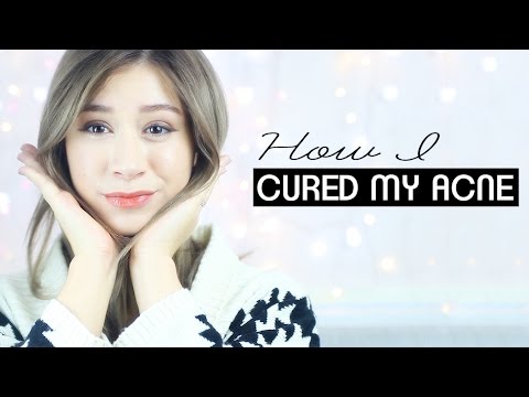 how to cure acne