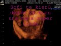 6 meses SOFIA JIMENA ultrasonido 4D