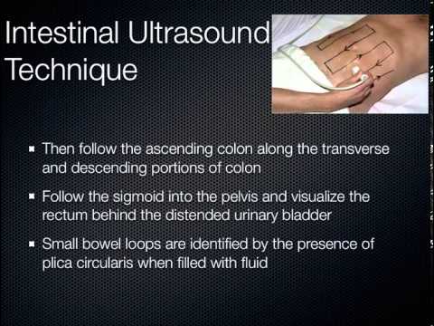 how to perform aortic ultrasound