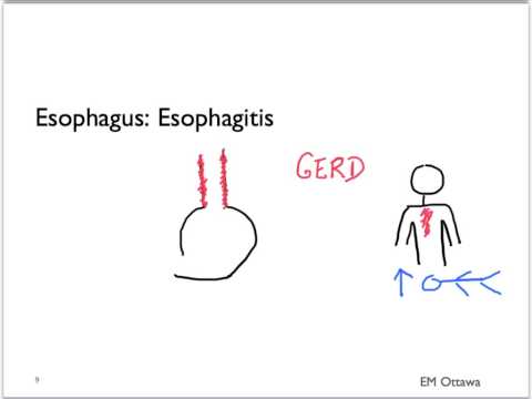 how to stop a g i bleed