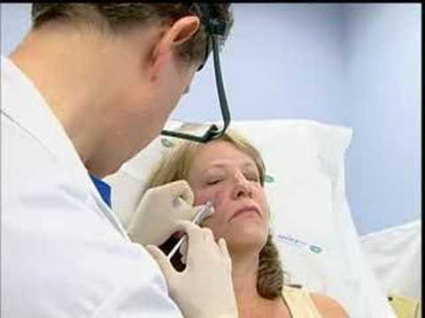 how to quickly dissolve stitches