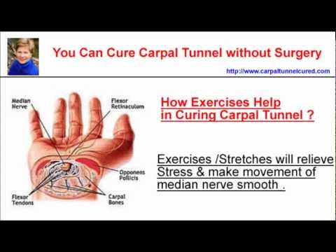 how to relieve carpal tunnel without surgery
