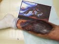 Kiss Tattoo