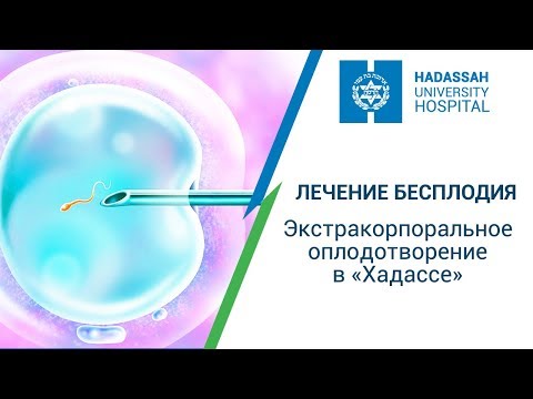 Видео: Клиника Хадасса в Израиле