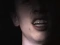 The Black Head Pop!