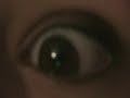 Thumbnail #1
