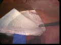 Dr Olajuwon Alabi performing laparoscopic ectopic surgery