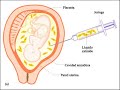 sabes mama-aborto