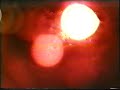 Kase.o - Tentaci�n (1994) Concierto Devizio