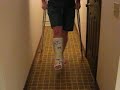 ky_caster crutching in a plaster SLWC