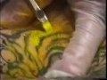 Horiyoshi is tattooing a backpiece Horiyoshi is tattooing a backpiece
