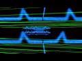 Einmusik - Altered Beyond Recognition (Official Video) [HQ]