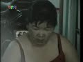 Bao hanh tre em