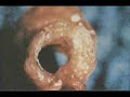 Doen�as Cardiovasculares