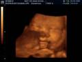 VALENTIN NICOLAS 33 SEMANAS DE EMBARAZO