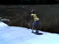 i-sprained-my-ankle.html