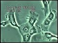 Effects of cytochalasin on MDBK cells