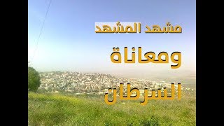 قرية المشهد والسرطان قرية المشهد والسرطان