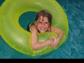 taylor-strand-burn-victim.html