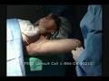 Smart lipo the ultimate non-surgical liposuction