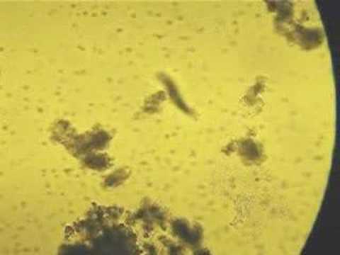what kind of Paramecium is this?
