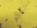 what kind of Paramecium is this?
