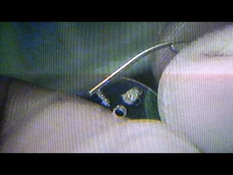 how to repair titanium eyeglass frames