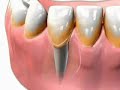 O que é Periodontia