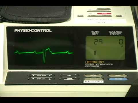 how to treat 3rd degree heart block