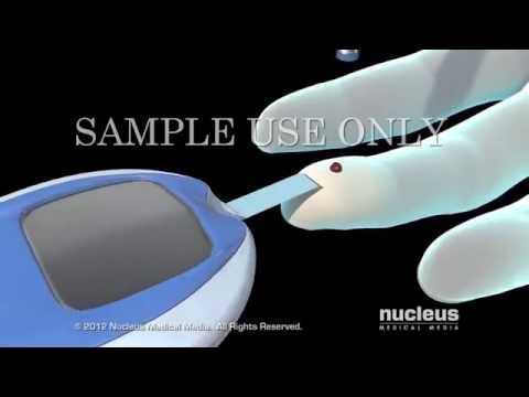 how to define diabetes