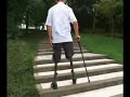 chinese dak on prosthetics