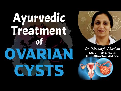 how to treat ovarian cysts at home