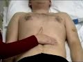 Abdominal Examination