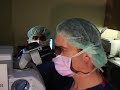 FREE LASIK Basics - Watch the LASIK Procedure FREE LASIK Basics - Watch the LASIK Procedure