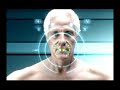 SpineForce back Pain Therapy in San Diego. SpineForce back Pain Therapy in San Diego.